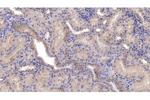 Detection of SFRP1 in Human Kidney Tissue using Monoclonal Antibody to Secreted Frizzled Related Protein 1 (SFRP1) (SFRP1 antibody  (AA 32-314))