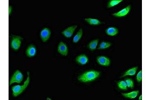 Immunofluorescent analysis of A549 cells using ABIN7145926 at dilution of 1:100 and Alexa Fluor 488-congugated AffiniPure Goat Anti-Rabbit IgG(H+L) (CCR3 antibody  (AA 306-355))