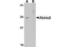 Western Blotting (WB) image for anti-Akirin 2 (AKIRIN2) (Middle Region 2) antibody (ABIN1031196) (AKIRIN2 antibody  (Middle Region 2))