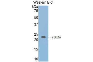 Western Blotting (WB) image for anti-phosphorylase, Glycogen, Liver (PYGL) (AA 341-509) antibody (ABIN1173786)
