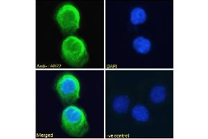 ABIN190867 Immunofluorescence analysis of paraformaldehyde fixed A431 cells, permeabilized with 0. (LARP1B antibody  (Internal Region))