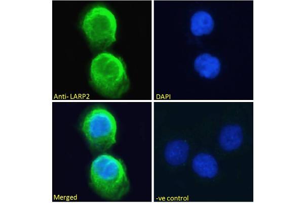 LARP1B antibody  (Internal Region)