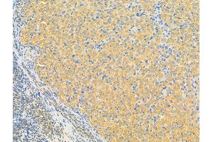 ABIN7093191 and ABIN7097196 at 1/100 staining Rat ovary tissue by IHC-P. (ERLIN2 antibody  (C-Term))
