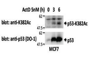 Western Blotting (WB) image for anti-Tumor Protein P53 (TP53) antibody (ABIN1449253) (p53 antibody)