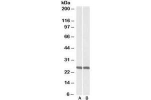 Western blot testing of mouse [A] and rat [B] brain lysate with UCHL1 antibody at 0. (UCHL1 antibody)