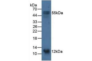Detection of S100A14 in Porcine Stomach Tissue using Polyclonal Antibody to S100 Calcium Binding Protein A14 (S100A14) (S100A14 antibody  (AA 1-91))
