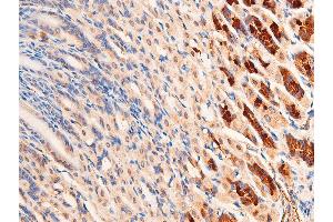 Immunohistochemistry (IHC) image for anti-Checkpoint Kinase 1 (CHEK1) (pSer296) antibody (ABIN6256251)