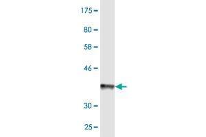 Western Blot detection against Immunogen (36. (ABCB6 antibody  (AA 743-842))