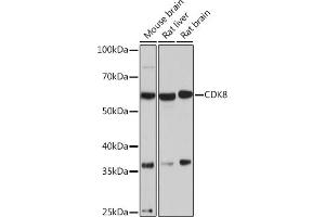Western blot analysis of extracts of various cell lines, using CDK8 Rabbit mAb (ABIN7266596) at 1:1000 dilution. (CDK8 antibody)