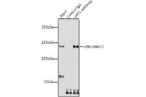 Immunoprecipitation analysis of 300 μg extracts of HeLa cells using 3 μg UPF1/RENT1 antibody (ABIN3022068, ABIN3022069, ABIN3022070 and ABIN6218593). (RENT1/UPF1 antibody  (AA 270-370))