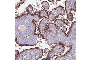 Immunohistochemical staining of human placenta with PTCD2 polyclonal antibody  shows strong cytoplasmic positivity in trophoblastic cells.