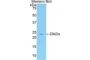 Western blot analysis of the recombinant protein. (Vitamin D-Binding Protein antibody  (AA 18-211))