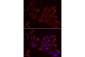 Immunofluorescence analysis of MCF7 cells using Pannexin 1 antibody (ABIN6128523, ABIN6145204, ABIN6145206 and ABIN6217644). (PANX1 antibody  (AA 297-426))