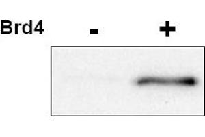 Image no. 1 for anti-Cyclin-Dependent Kinase 9 (CDK9) (pThr29) antibody (ABIN401390)
