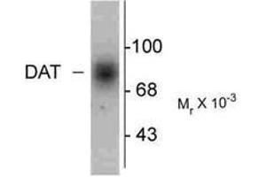 Image no. 1 for anti-Solute Carrier Family 6 (Neurotransmitter Transporter, Dopamine), Member 3 (SLC6A3) (C-Term) antibody (ABIN227451) (SLC6A3 antibody  (C-Term))