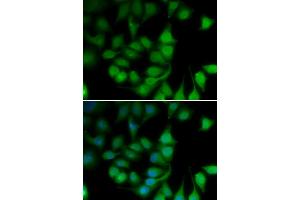 Immunofluorescence analysis of U2OS cells using POLR2H antibody.