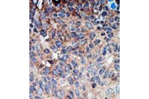 Image no. 2 for anti-Non-Metastatic Cells 1, Protein (NM23A) Expressed in (NME1) (N-Term) antibody (ABIN360544) (NME1 antibody  (N-Term))