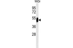 Western Blotting (WB) image for anti-SET Domain Containing 6 (SETD6) antibody (ABIN3002146)