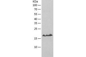 Western Blotting (WB) image for ATP-Binding Cassette, Sub-Family A (ABC1), Member 5 (ABCA5) (AA 1464-1642) protein (His tag) (ABIN7121928) (ABCA5 Protein (AA 1464-1642) (His tag))