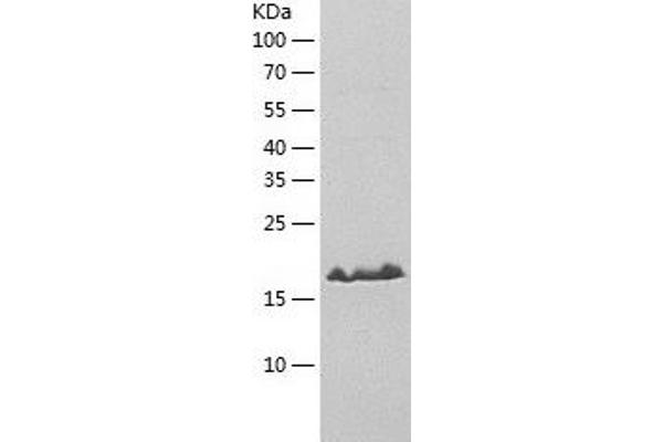 ABCA5 Protein (AA 1464-1642) (His tag)