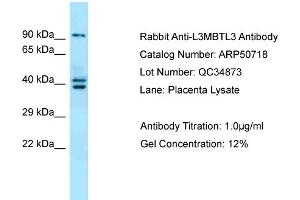 WB Suggested Anti-L3MBTL3 Antibody Titration:  0.