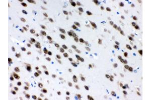 Anti- ELAVL4 Picoband antibody, IHC(P) IHC(P): Rat Brain Tissue (ELAVL4 antibody  (N-Term))
