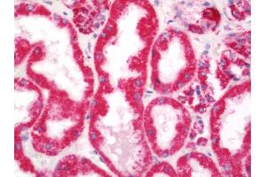 Immunohistochemistry (Paraffin-embedded Sections) (IHC (p)) image for anti-Glutamic-Oxaloacetic Transaminase 2, Mitochondrial (Aspartate Aminotransferase 2) (GOT2) antibody (FITC) (ABIN1957234)