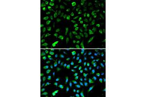 Immunofluorescence analysis of A549 cell using NME1 antibody. (NME1 antibody  (C-Term))
