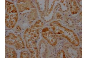 IHC image of ABIN7127384 diluted at 1:100 and staining in paraffin-embedded human kidney tissue performed on a Leica BondTM system. (Recombinant Caspase 2 antibody)