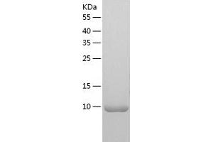 Western Blotting (WB) image for Ubiquitin-Fold Modifier 1 (UFM1) (AA 1-83) protein (His tag) (ABIN7286668) (UFM1 Protein (AA 1-83) (His tag))