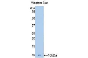 Western Blotting (WB) image for anti-Mucin 5 Subtype B (MUC5B) (AA 5366-5444) antibody (ABIN1078357) (MUC5B antibody  (AA 5366-5444))