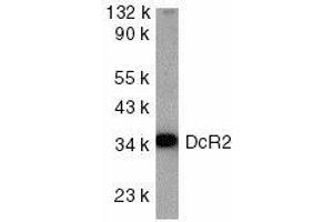 Western blot analysis of DcR2 in HeLa cell lysate with DcR2 antibody at 1ug/ml. (DcR2 antibody)