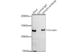Immunoprecipitation analysis of 300 μg extracts of HeLa cells using 3 μg Vinculin antibody (ABIN3016604, ABIN3016605, ABIN1680530 and ABIN1680531). (Vinculin antibody)