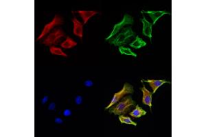ABIN6265100 and ABIN6272929 staining Hela cells by IF/ICC. (SKAP2 antibody  (C-Term))