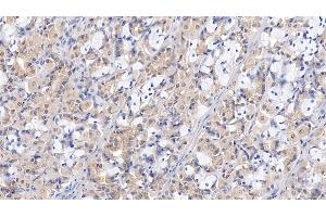 Detection of WTAP in Human Stomach Tissue using Polyclonal Antibody to Wilms Tumor 1 Associated Protein (WTAP) (WTAP antibody  (AA 1-150))