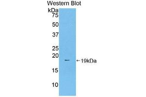 Western blot analysis of the recombinant protein. (Prothrombin antibody  (AA 44-200))
