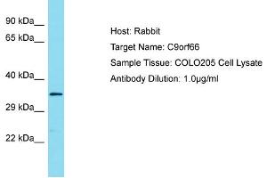 Host: Rabbit Target Name: C9ORF66 Sample Tissue: Human COLO205 Whole Cell Antibody Dilution: 1ug/ml (C9ORF66 antibody  (C-Term))