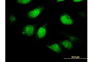 Immunofluorescence of purified MaxPab antibody to TSNAXIP1 on HeLa cell. (Tsnaxip1 antibody  (AA 1-366))