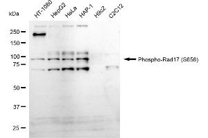 Western blotting analysis using Phospho-Rad17 (S656) antibody (ABIN7800113). (Recombinant RAD17 antibody  (pSer656))
