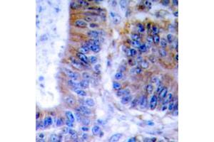 Immunohistochemical analysis of TNFAIP1 staining in human colon formalin fixed paraffin embedded tissue section. (TNFAIP1 antibody  (Center))