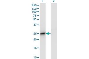Western Blot analysis of DC-UbP expression in transfected 293T cell line by DC-UbP monoclonal antibody (M01), clone 1B8-1B1. (UBTD2 antibody  (AA 1-190))