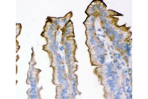 IHC analysis of Plectin using anti-Plectin antibody (ABIN3043900). (PLEC antibody  (Middle Region))