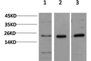 Western Blotting (WB) image for anti-Chromobox Homolog 5 (CBX5) antibody (ABIN5957538) (CBX5 antibody)