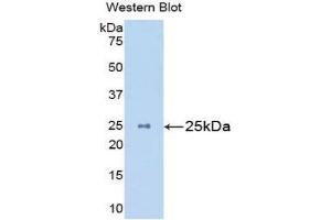 Western Blotting (WB) image for anti-Mannan-Binding Lectin serine Peptidase 2 (MASP2) (AA 22-142) antibody (ABIN3207660) (MASP2 antibody  (AA 22-142))