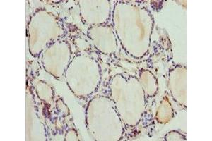Immunohistochemistry of paraffin-embedded human thyroid tissue using ABIN7163635 at dilution of 1:100 (PLEKHA1 antibody  (AA 285-404))