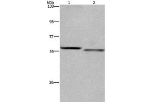 Western Blot analysis of K562 and A431 cell using FRK Polyclonal Antibody at dilution of 1:1200