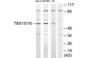 Western blot analysis of extracts from HuvEc/HeLa/Jurkat cells, using TBX15/18 Antibody. (T-Box 15/18 antibody  (AA 161-210))