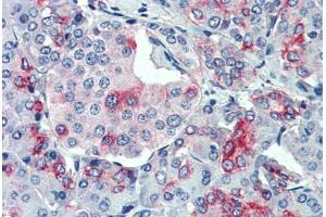 Anti-SLC11A2 antibody  ABIN1049329 IHC staining of human, pancreas. (SLC11A2 antibody  (Internal Region))