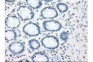 Immunohistochemical staining of paraffin-embedded colon tissue using anti-CHEK2mouse monoclonal antibody. (CHEK2 antibody)