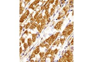 Immunohistochemistry (Paraffin-embedded Sections) (IHC (p)) image for anti-MORC Family CW-Type Zinc Finger 3 (MORC3) (AA 634-663) antibody (ABIN1881548)